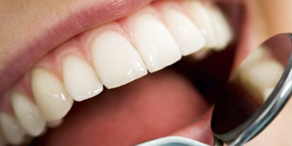 Combat Bad Breath with Professional Dental Care