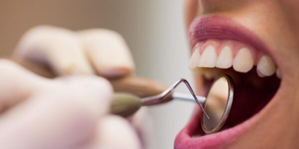 Is it Good to do a Dental Checkup Every 6 Months?