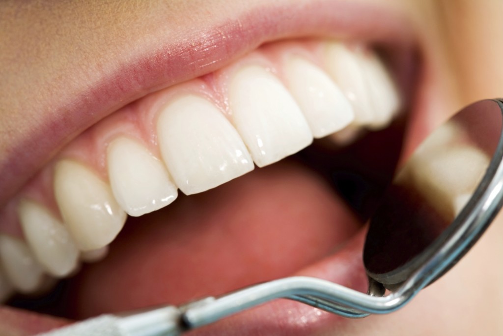 Restore Smiles with Expert Dental Implants