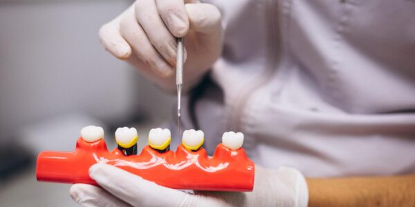 The Kinds of Qualifications You Want to Look For in a Top Dentist